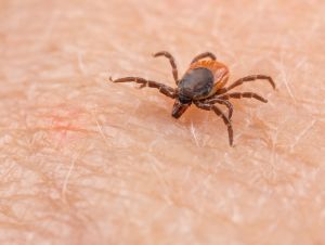 A tick on a human body.