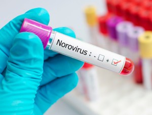 Norovirus positive blood tube